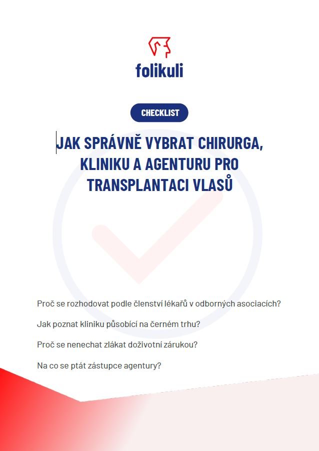 Checklist: Jak správně vybrat chirurga, kliniku a agenturu pro transplantaci vlasů
