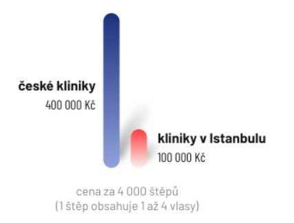 Srovnání cen za transplantaci vlasů v Česku a Turecku